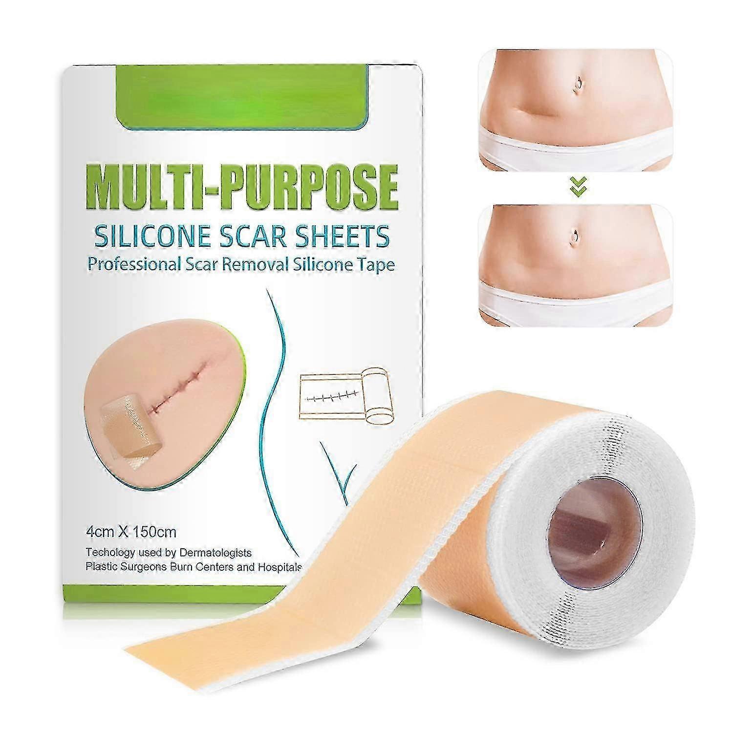 Silicone Plasters For Scars -aqwg