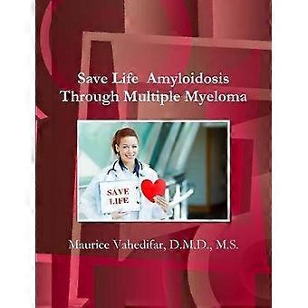 Save Life Amyloidosis Through Multiple Myeloma