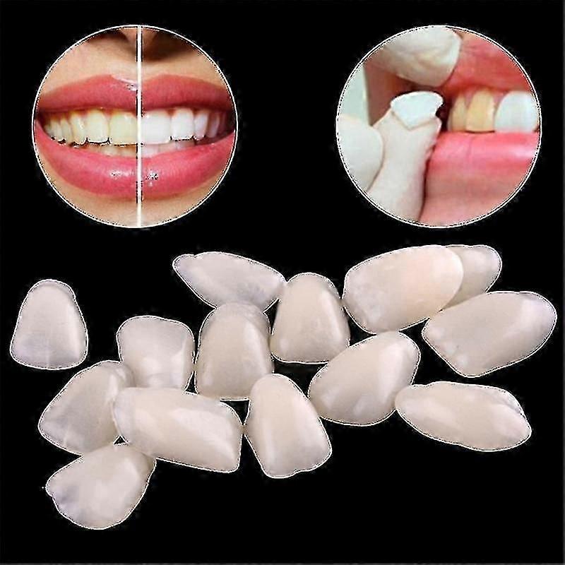 Dental Ultra-ince Beyazlatıcı Kaplamalar Reçine Diş Üst Ön Gölge 50 Adet