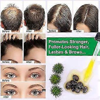 Castor Oil, Organic Castor Oil, Pure Castor Oil Helps Stimulates Hair Growth, Moisturizes the Scalp and Reduce Dandruff, Reduce Fine Lines a