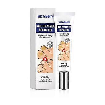 Removing Gray Nail Repair Soft Nail Cream, Removing Gray Nails, Hands And Feet, Brightening Nail Care