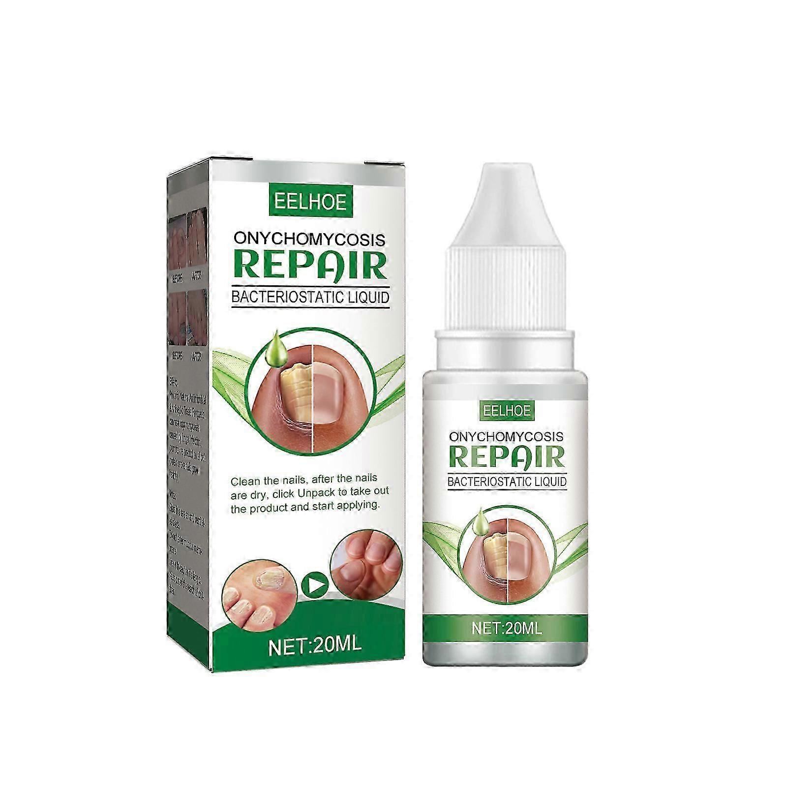 Onychomycosis Nutrient Solution Onychomycosis Thick