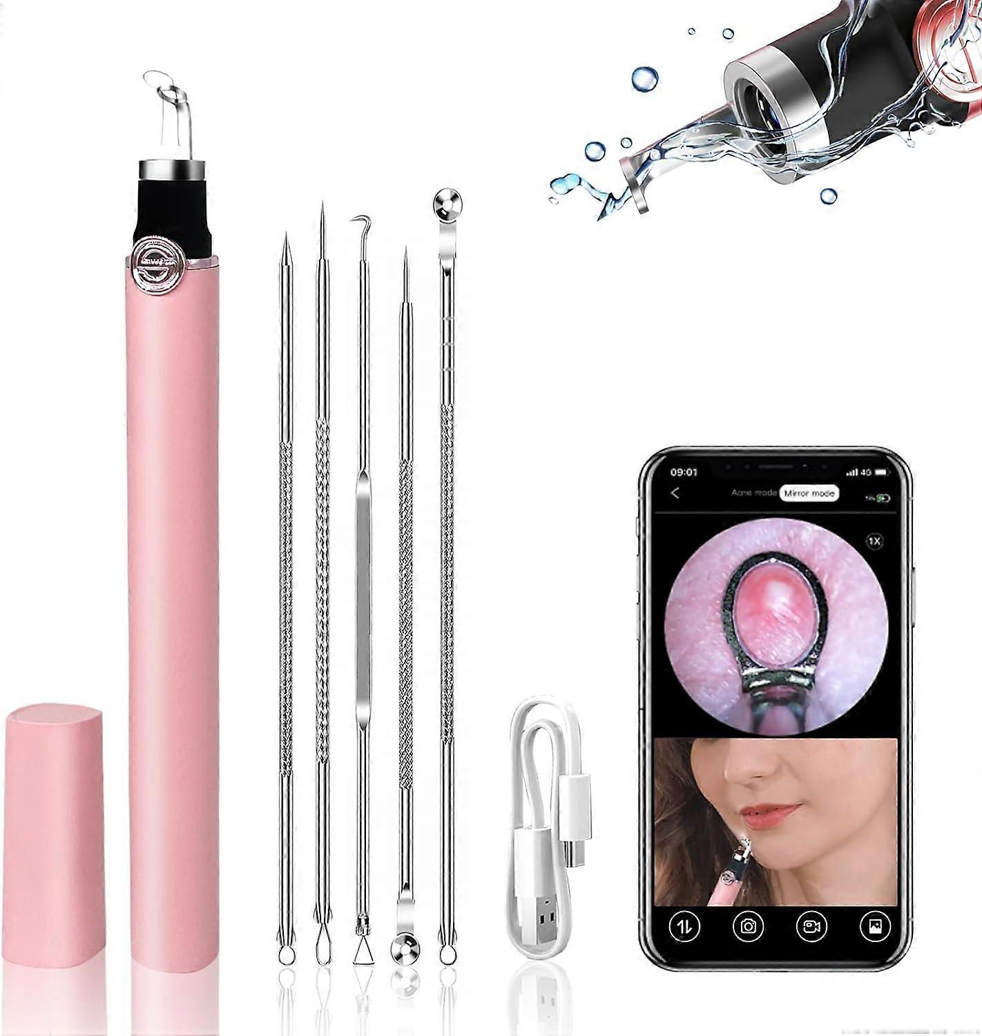 Visible Blackhead Remover, Advanced Pimple Popper with 20X Camera, Rechargeable Blackhead Extractor Tools for iPhone Android, Pore Cleaner Kit