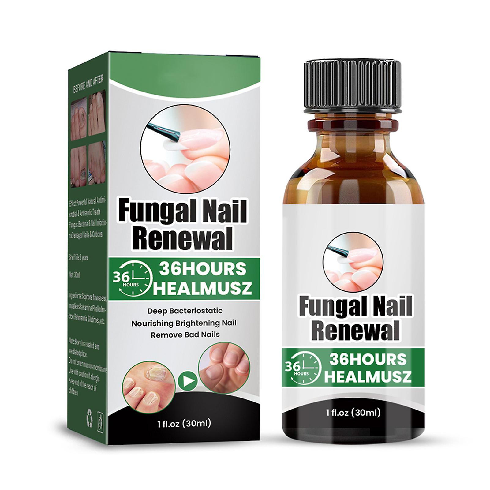 Toenail Treatments Liquid Easy to Use Easy to Absorb Anti-Nail Onychomycosis Liquid for Men Women