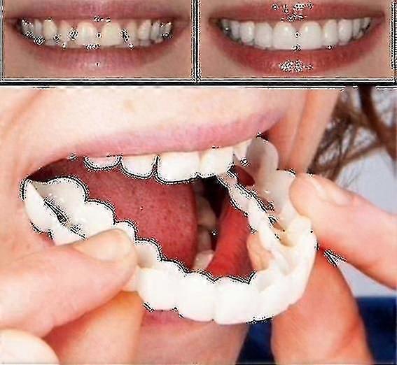 Artificial Teeth Set  Silicone Upper and Lower Teeth