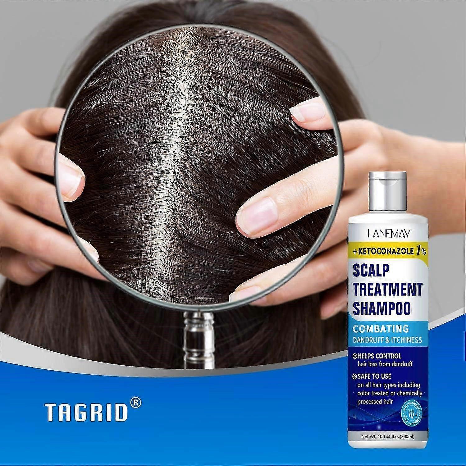 ケトコナゾール頭皮治療シャンプー - フケ防止シャンプー - 頭皮のかゆみの緩和、脂漏性皮膚炎、毛嚢炎治療、乾癬シャンプー -