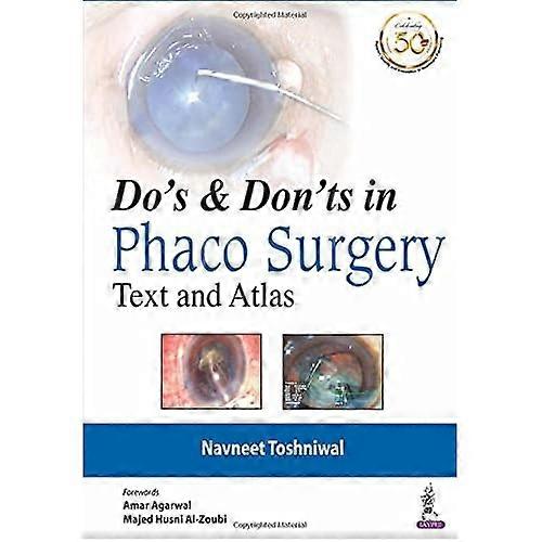 Do's & Dont's in Phaco Surgery: Text and Atlas