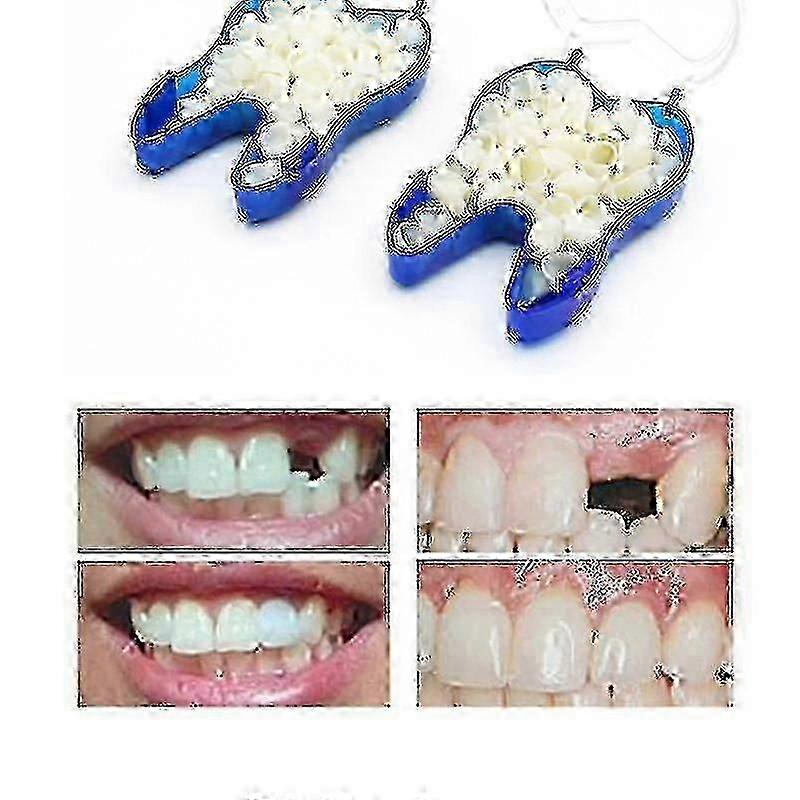 2026 Temporary Denture Braces Occlude Upper Dentures Veneer Dentures Missing Teeth Broken Teeth