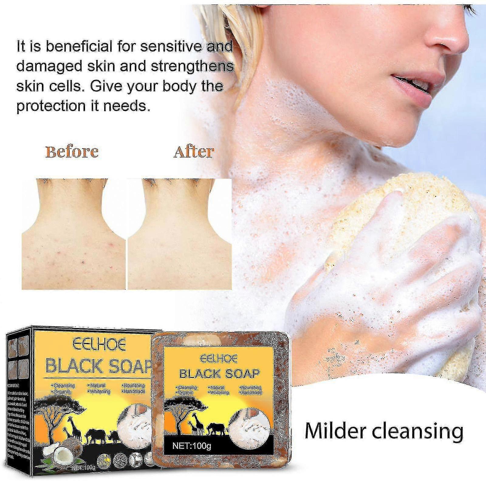 Itching And Acne Soap GHR