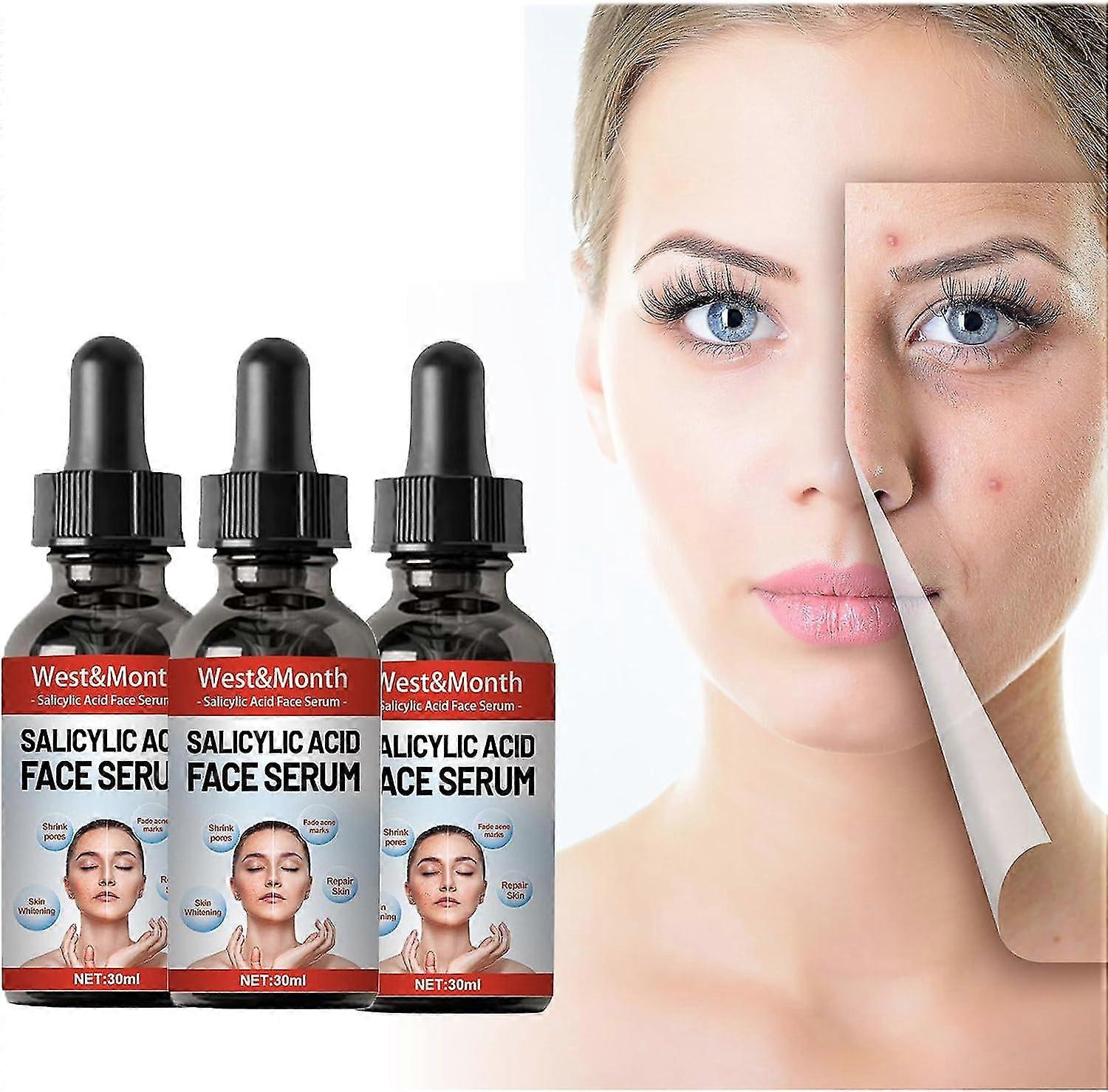 Salicylic Acid Face Serum, Anti-Acne and Blemished Skin Facial Serum with Salicylic Acid, Help to Reduce Impurities, Pores and Blackheads