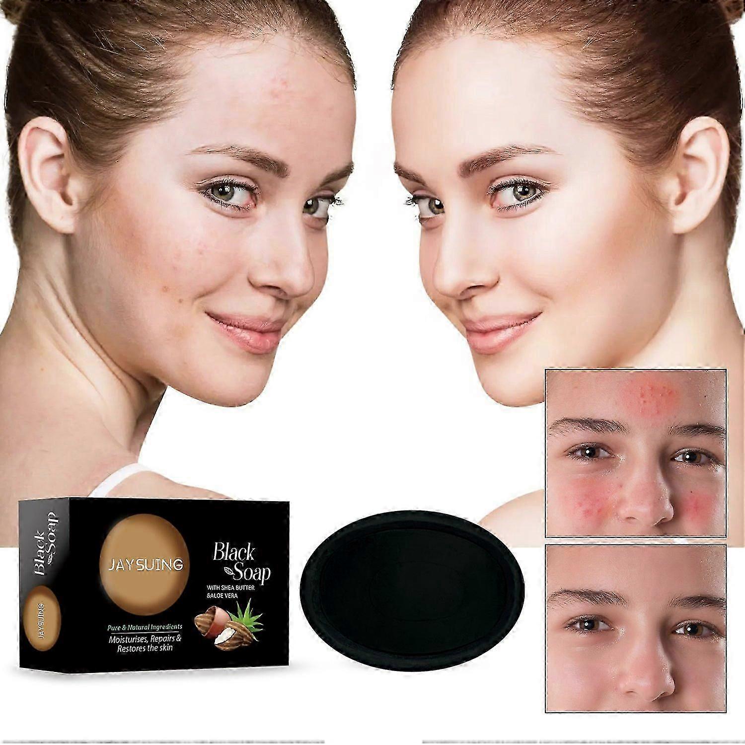 Jaysuing Shea Butter Black Soap, Repair Acne Pimple Acne Clear Pores Moisturize Smooth Skin Soap