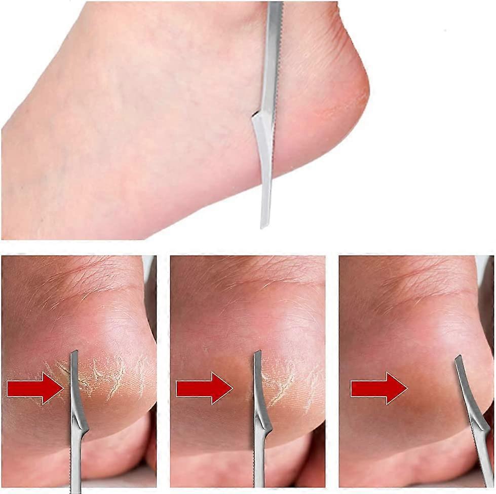 Peeling Del Piede Rimozione Della Pialla Del Piede Del Callo Del Tallone, 1pz Lima Per Piedi Per - Foto 10