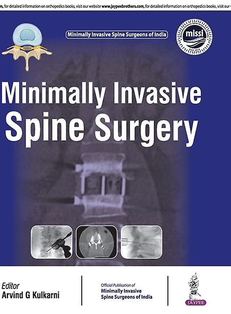 Minimally Invasive Spine Surgery by Arvind Kulkarni Hardback Book