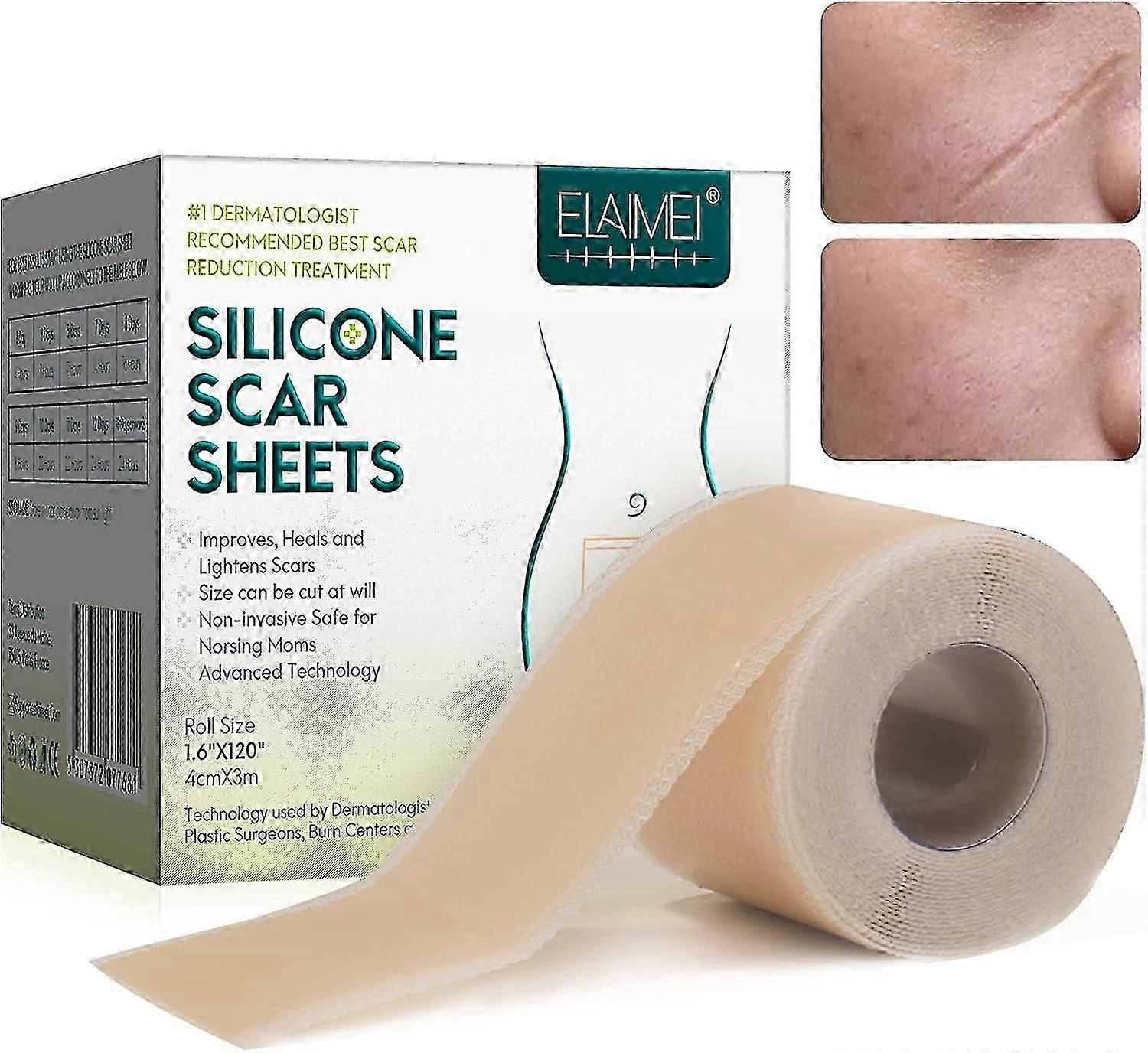 اللصقات سيليكون للندبات ، أفلام ندبة سيليكون للعمليات الجراحية ، العملية القيصرية ، الجدرة ، الحروق ، شريط ندبة السيليكون - 4 سم * 3 م