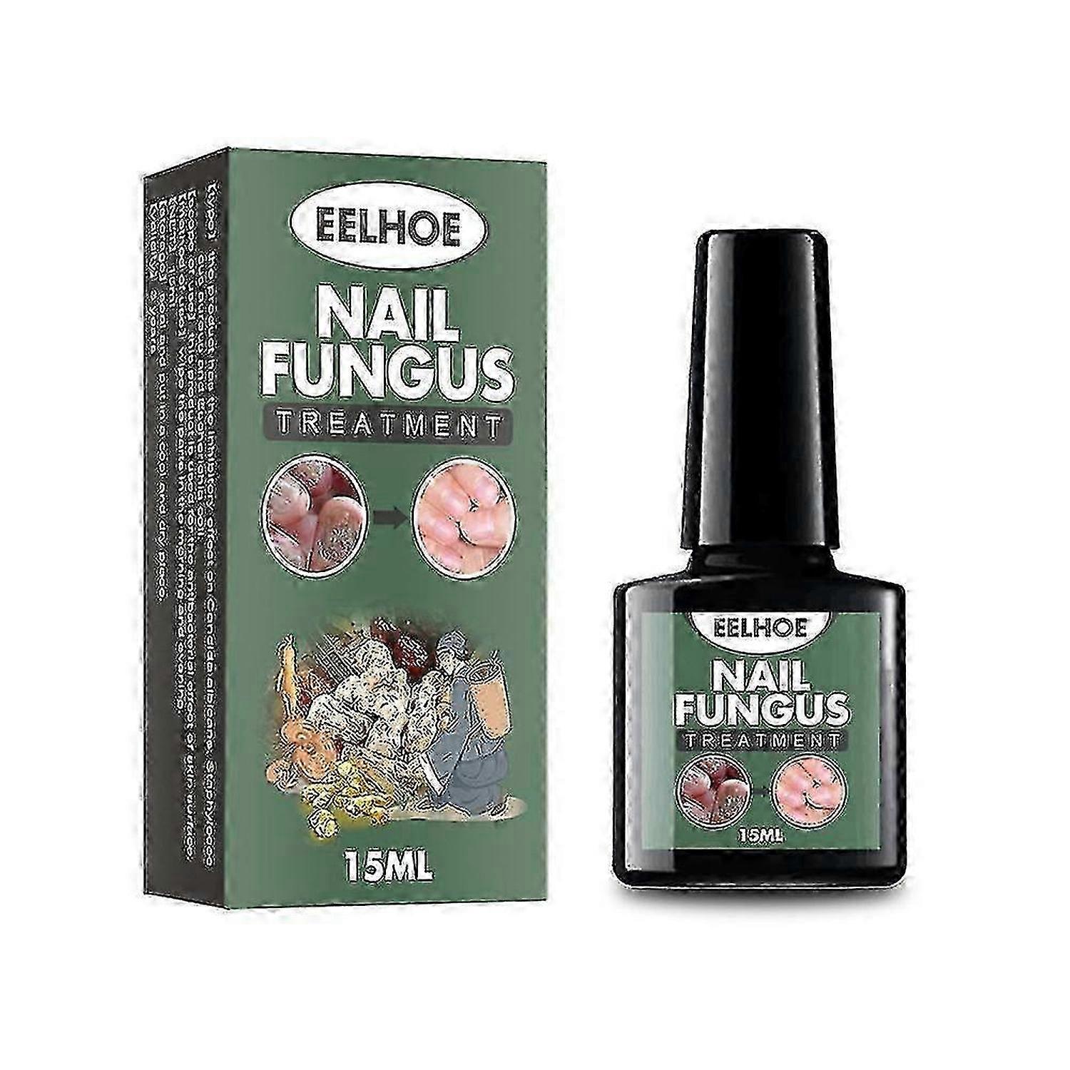 Επιπλέον δύναμη Nail Repair Fluid Νύχια Και Νύχι Λύση Νύχια Νύχια Και Νύχια Επισκευή Κατεστραμμένα και Αποχρωματισμένα Νύχια Φυσικά Προμήθειες
