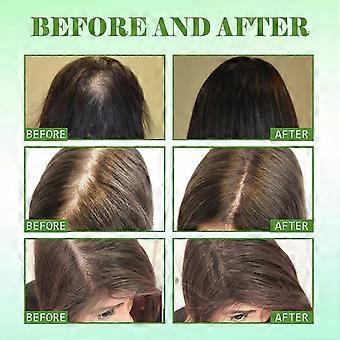 Organic Rosemary Oil for Hair Growth, Pure Rosemary Essential Oil Scalp & Hair Strengthening Hair Treatment Oil for Dry Scalp Hair